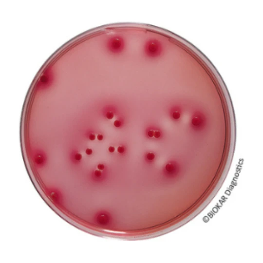 Desoxycholate Lactose Agar 500 G